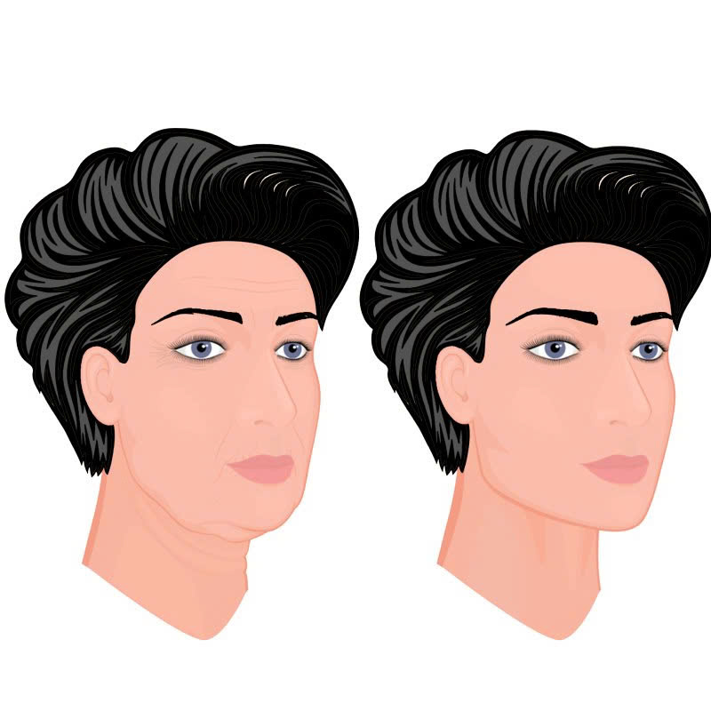 nang-midface-co-dau-khong-giai-dap-chi-tiet-tu-a-z-cho-nguoi-lan-dau-tim-hieu