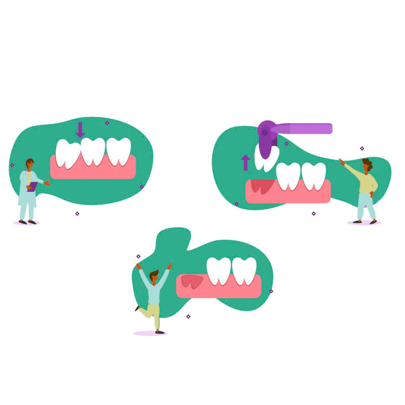 nho-rang-khon-co-nguy-hiem-khong-nhung-luu-y-ban-can-nam-truoc-khi-thuc-hien