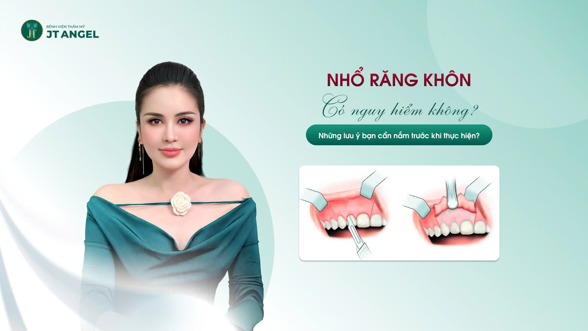 nho-rang-khon-co-nguy-hiem-khong-nhung-luu-y-ban-can-nam-truoc-khi-thuc-hien