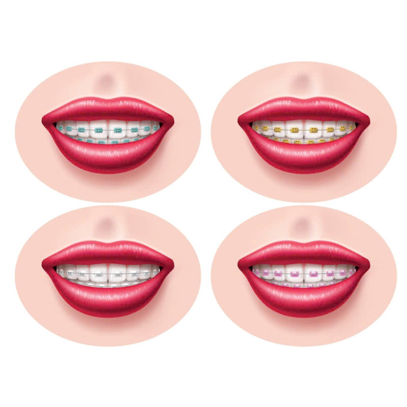 nieng-rang-bang-mac-cai-kim-loai-vuot-qua-tu-ti-vi-rang-ho-mom-ham-rang-khong-deu