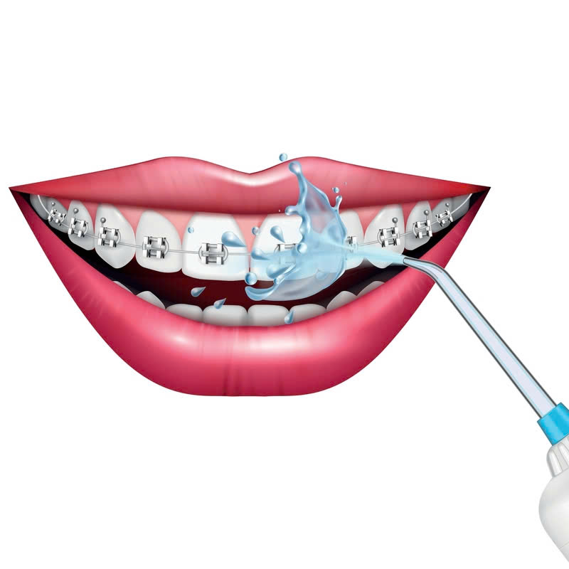 nieng-rang-bang-mac-cai-kim-loai-vuot-qua-tu-ti-vi-rang-ho-mom-ham-rang-khong-deu