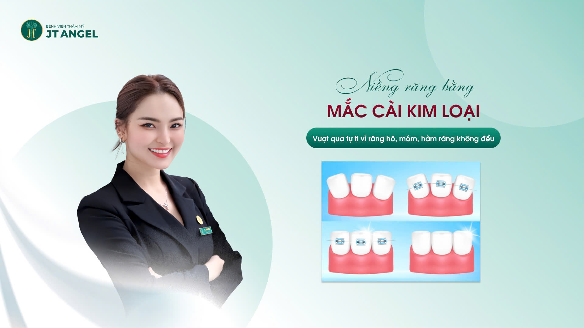 nieng-rang-bang-mac-cai-kim-loai-vuot-qua-tu-ti-vi-rang-ho-mom-ham-rang-khong-deu