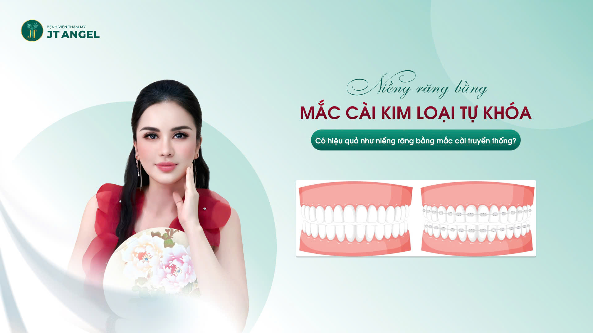 nieng-rang-bang-mac-cai-kim-loai-tu-khoa-la-gi-co-hieu-qua-nhu-nieng-rang-bang-mac-cai-truyen-thong