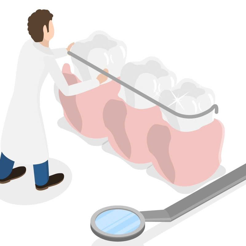 nieng-rang-bang-mac-cai-su-la-gi-nhung-dieu-can-biet-truoc-khi-dieu-chinh-khuyet-diem-ham-rang