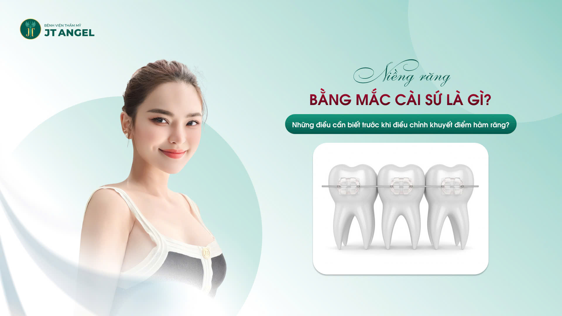 nieng-rang-bang-mac-cai-su-la-gi-nhung-dieu-can-biet-truoc-khi-dieu-chinh-khuyet-diem-ham-rang