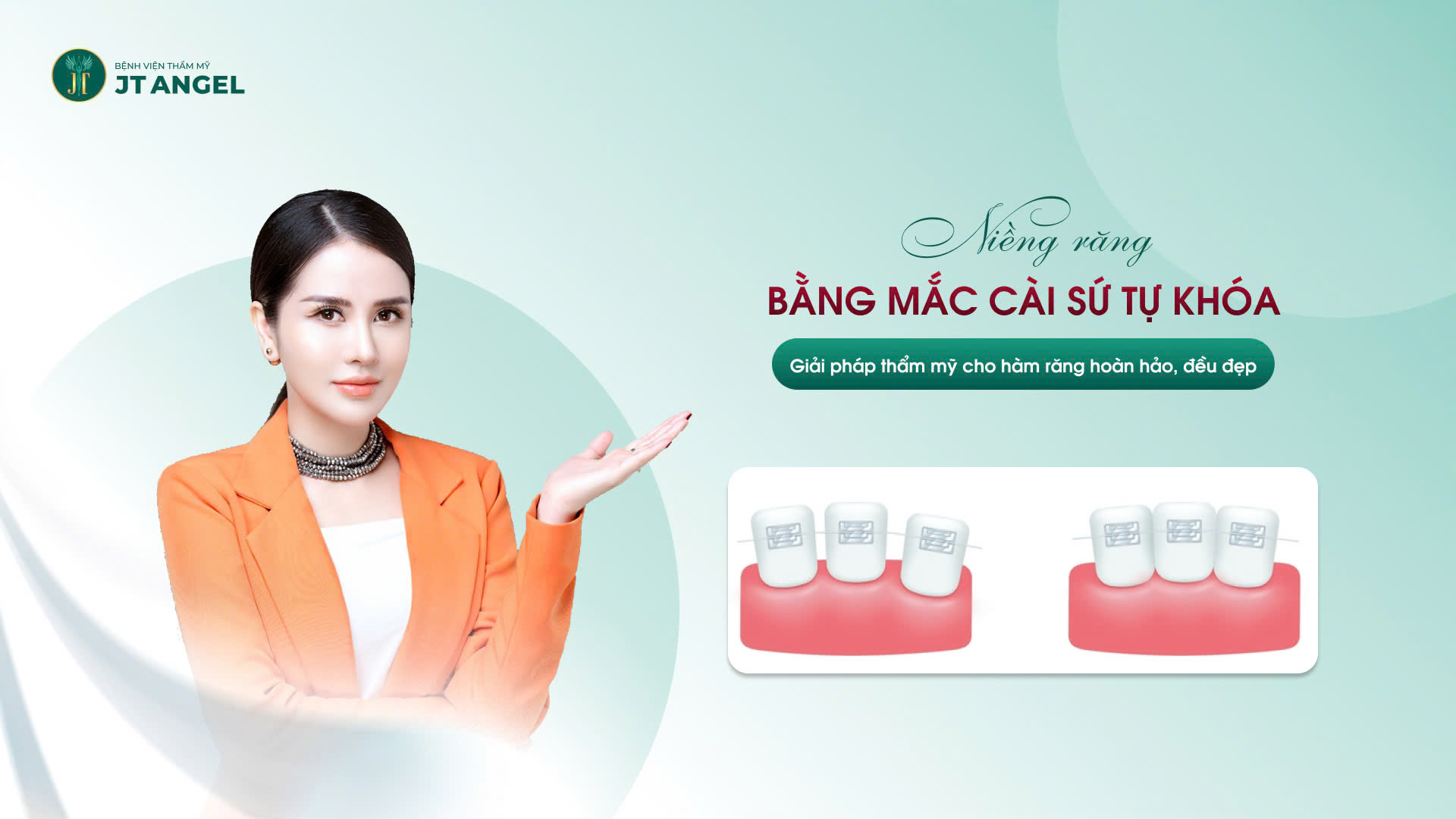 nieng-rang-bang-mac-cai-su-tu-khoa-giai-phap-tham-my-cho-ham-rang-hoan-hao-deu-dep-khong-gay-com-hay-kho-chiu