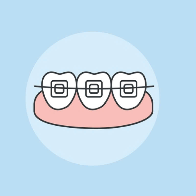 nieng-rang-bang-mac-cai-su-tu-khoa-giai-phap-tham-my-cho-ham-rang-hoan-hao-deu-dep-khong-gay-com-hay-kho-chiu