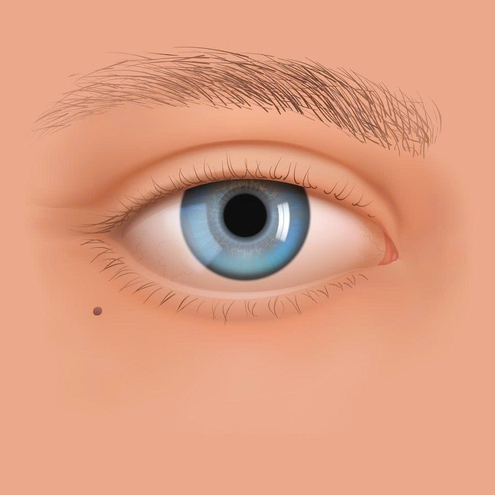 co-nen-phau-thuat-lay-silicone-vung-mat-cung-tim-hieu-chi-tiet-quy-trinh-uu-diem-va-nhung-doi-tuong-nen-thuc-hien-phuong-phap-nay