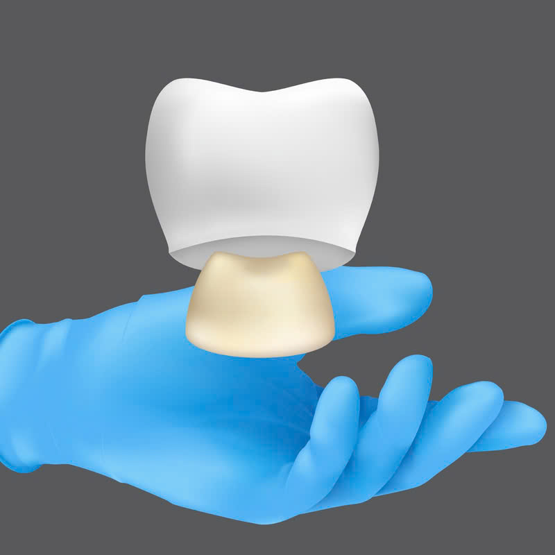 loi-ich-cua-phuc-hinh-su-cercon-tu-ben-dep-den-tu-nhien