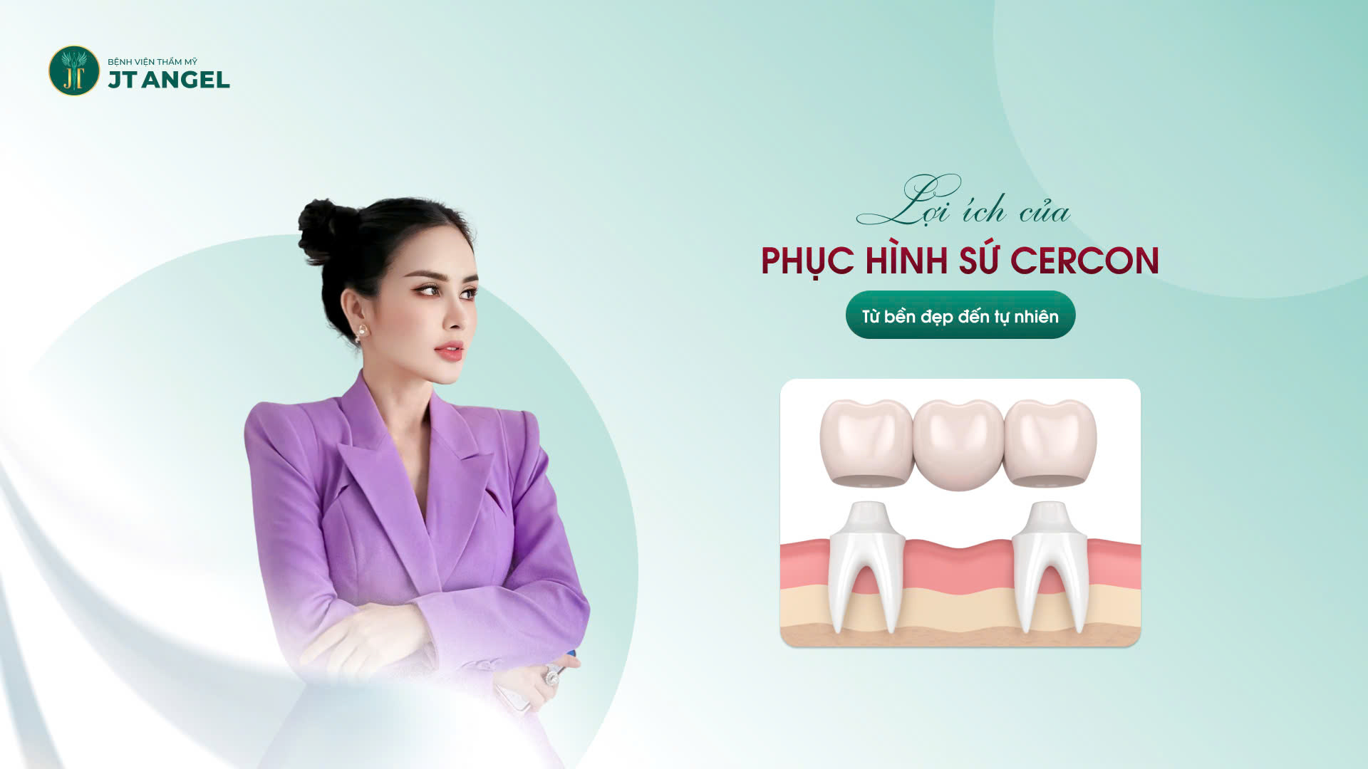 loi-ich-cua-phuc-hinh-su-cercon-tu-ben-dep-den-tu-nhien