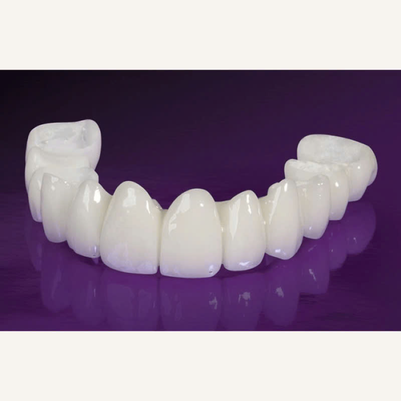 rang-su-lava-plus-la-gi-nhung-doi-tuong-nao-phu-hop-voi-loai-rang-su-nay