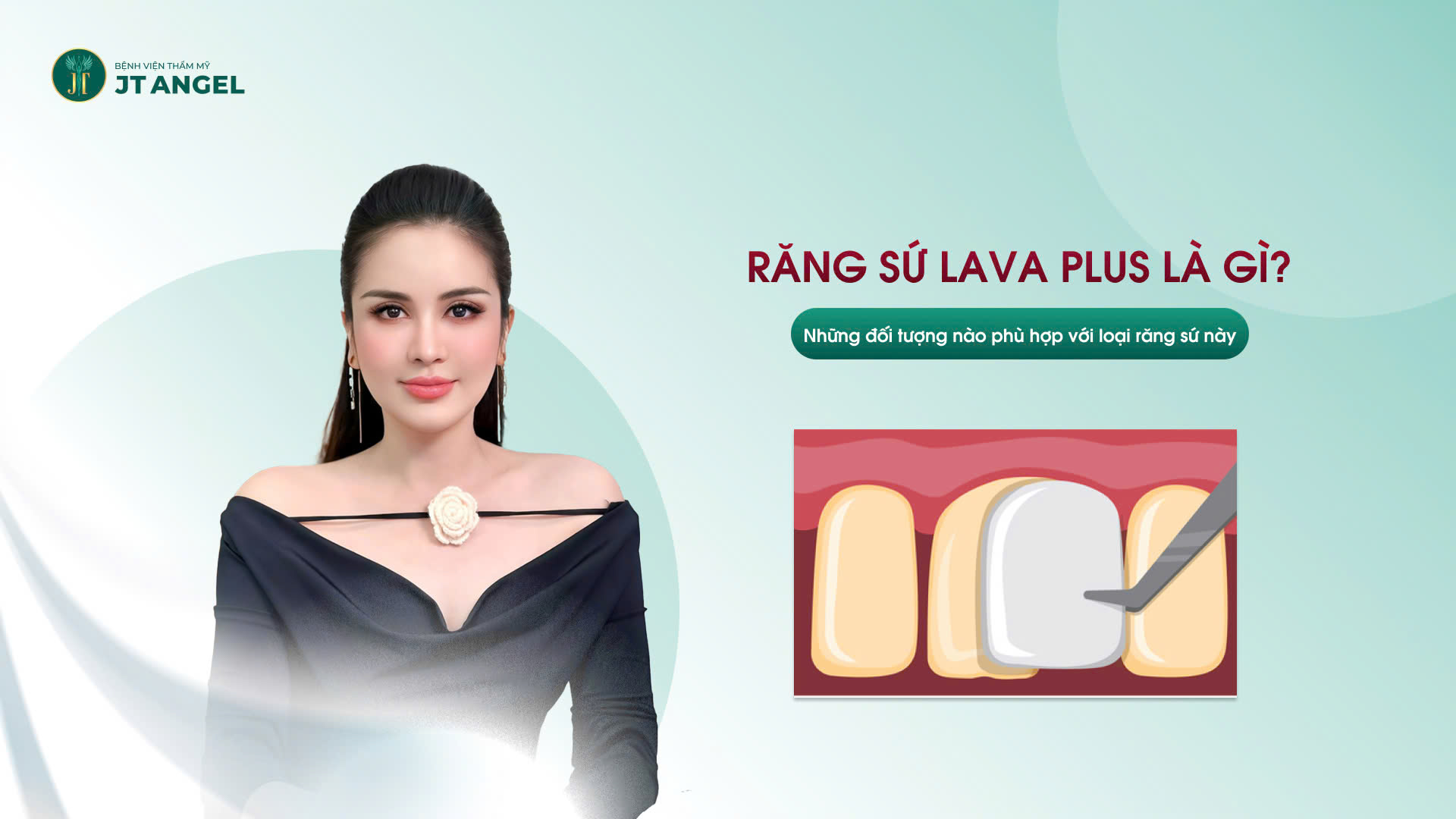 rang-su-lava-plus-la-gi-nhung-doi-tuong-nao-phu-hop-voi-loai-rang-su-nay
