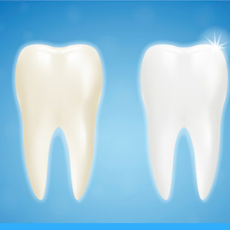 cung-tim-hieu-ve-rang-su-orodent-bleach-va-nhung-luu-y-khi-thuc-hien-dich-vu