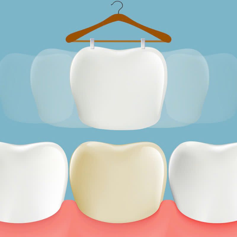 cung-tim-hieu-ve-rang-su-orodent-bleach-va-nhung-luu-y-khi-thuc-hien-dich-vu