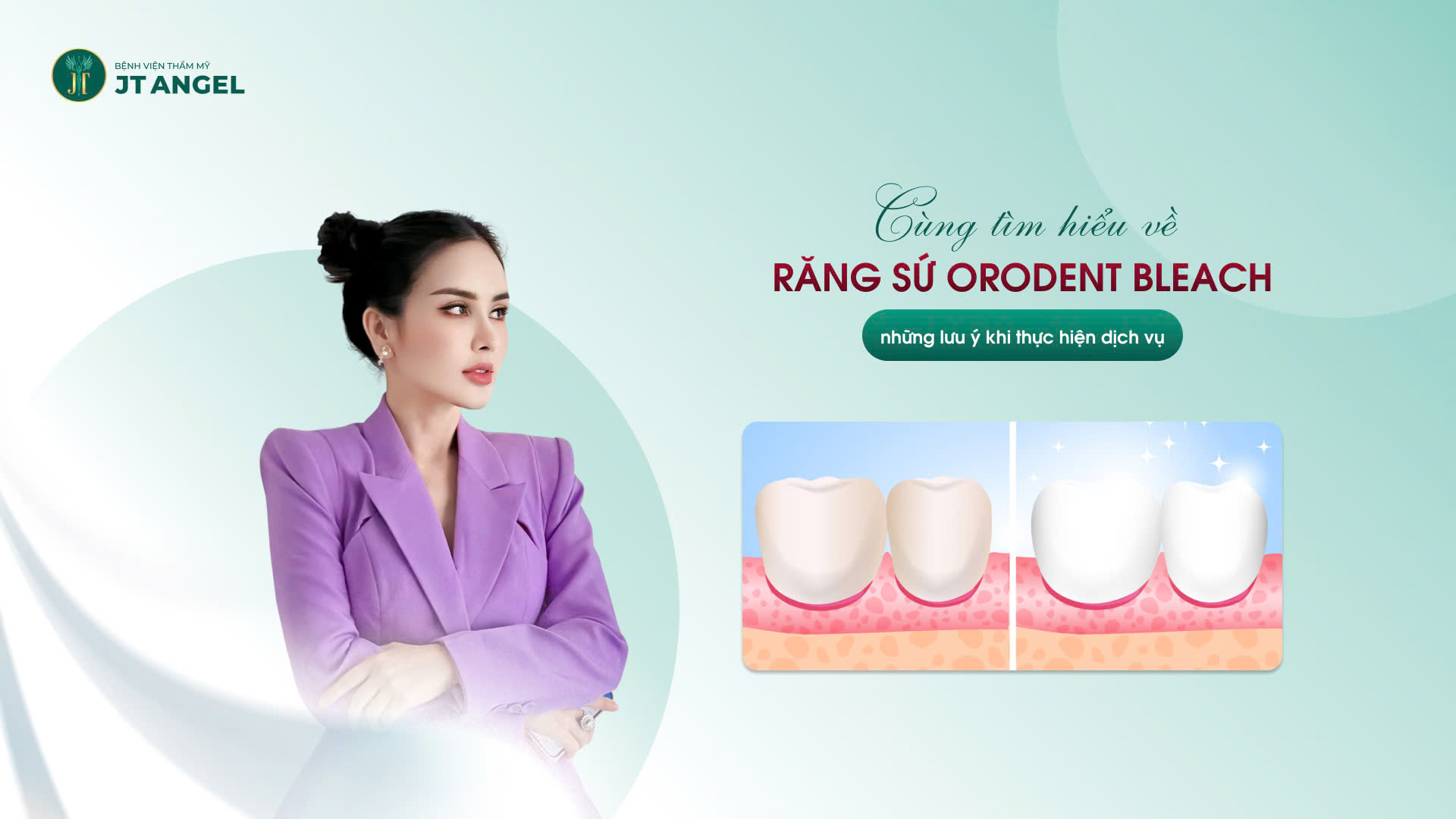 cung-tim-hieu-ve-rang-su-orodent-bleach-va-nhung-luu-y-khi-thuc-hien-dich-vu