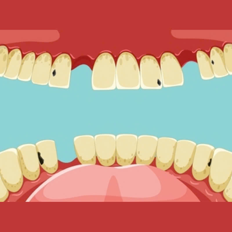tai-sao-rang-su-y-la-lua-chon-hang-dau-cho-nguoi-muon-cai-thien-nu-cuoi