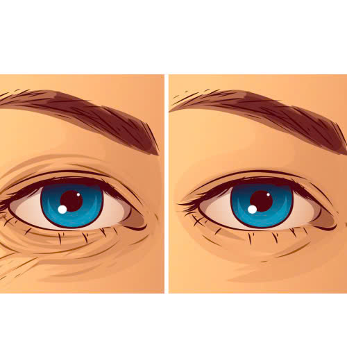 review-cay-mo-mat-trai-nghiem-that-ket-qua-that-va-dieu-can-biet-truoc-khi-lam