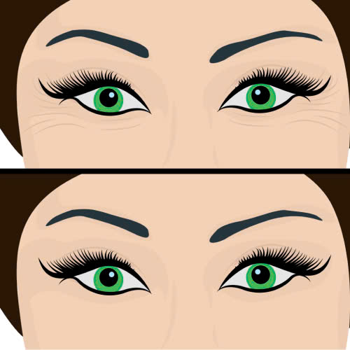 review-cay-mo-mat-trai-nghiem-that-ket-qua-that-va-dieu-can-biet-truoc-khi-lam