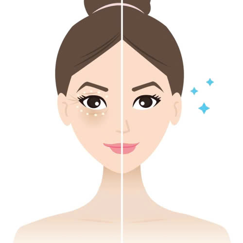 review-cay-mo-mat-trai-nghiem-that-ket-qua-that-va-dieu-can-biet-truoc-khi-lam