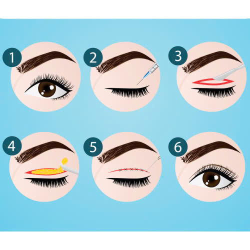 review-lay-mo-mi-tren-chia-se-thuc-te-va-kinh-nghiem-giup-doi-mat-tre-dep-tu-nhien