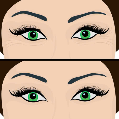 review-xoa-nhan-duoi-mat-hieu-qua-that-su-hay-chi-la-loi-quang-cao