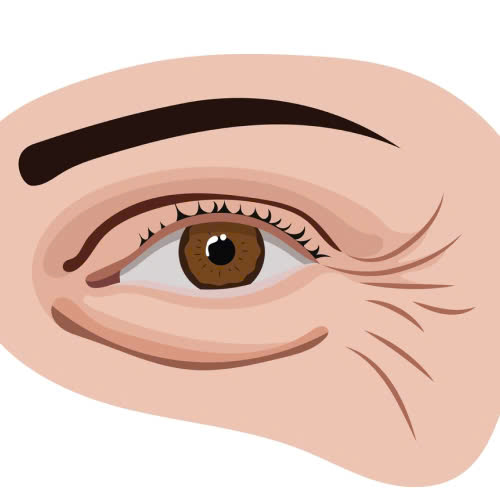 review-xoa-nhan-duoi-mat-hieu-qua-that-su-hay-chi-la-loi-quang-cao