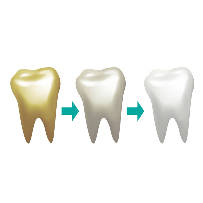 tay-trang-rang-loai-bo-hoan-toan-vet-o-vang-den-sam-tra-lai-nu-cuoi-trang-sang-tu-nhien