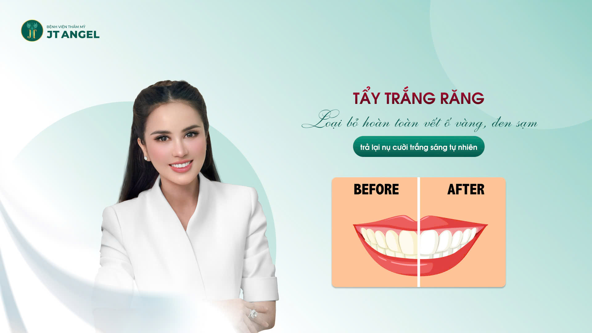 tay-trang-rang-loai-bo-hoan-toan-vet-o-vang-den-sam-tra-lai-nu-cuoi-trang-sang-tu-nhien