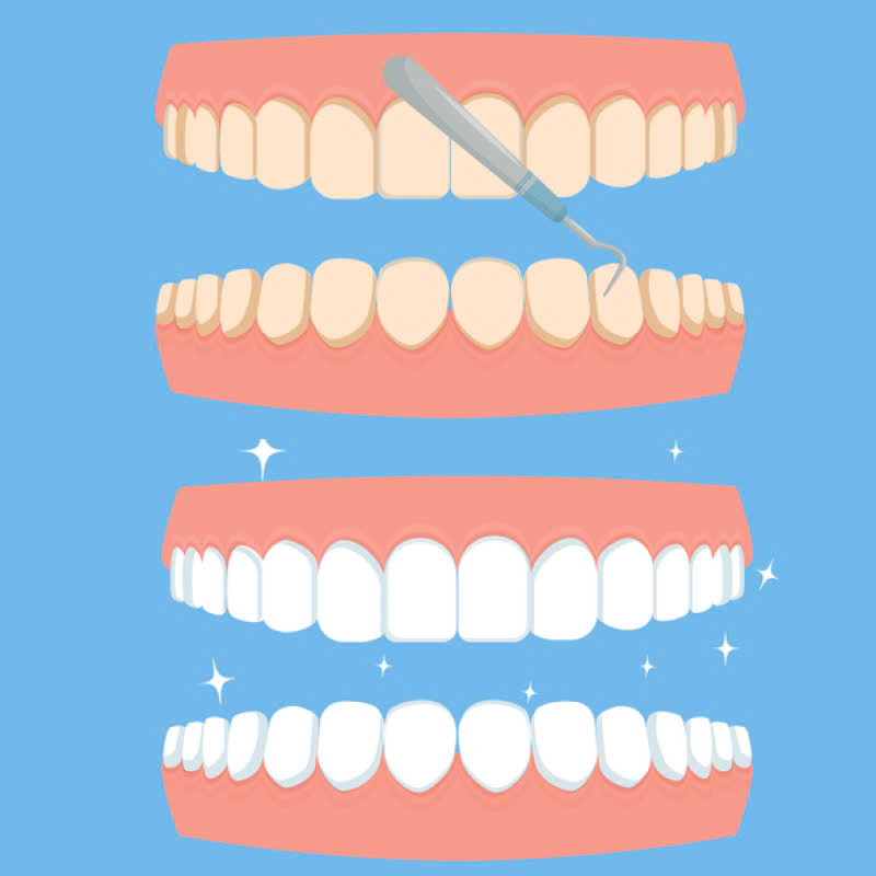 tay-trang-rang-loai-bo-hoan-toan-vet-o-vang-den-sam-tra-lai-nu-cuoi-trang-sang-tu-nhien