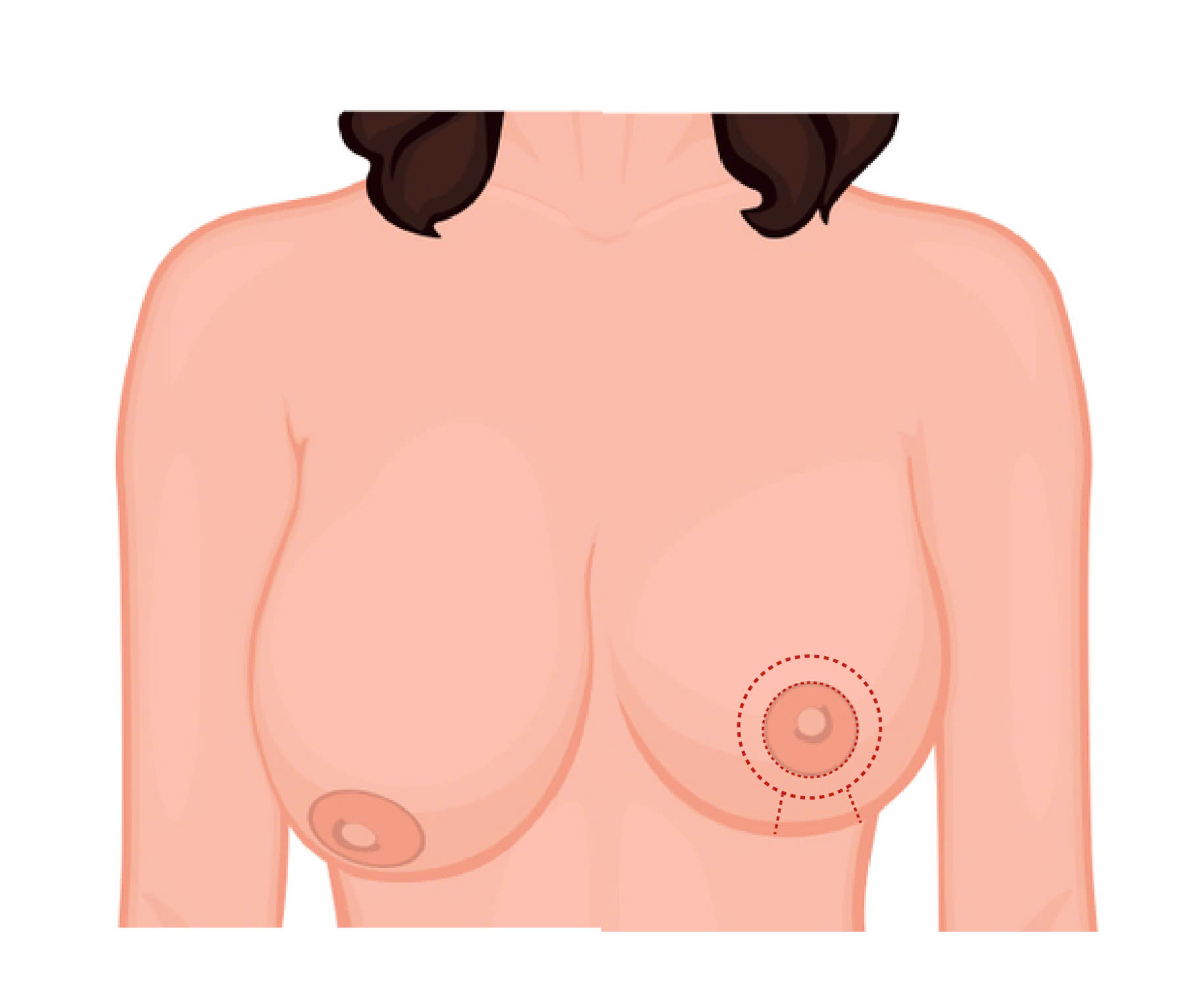 treo-sa-tre-nguc-cho-nguc-chay-xe-bi-quyet-giup-cai-thien-vong-1-sau-sinh-hieu-qua-an-toan-san-chac-cho-chi-em-me-bim