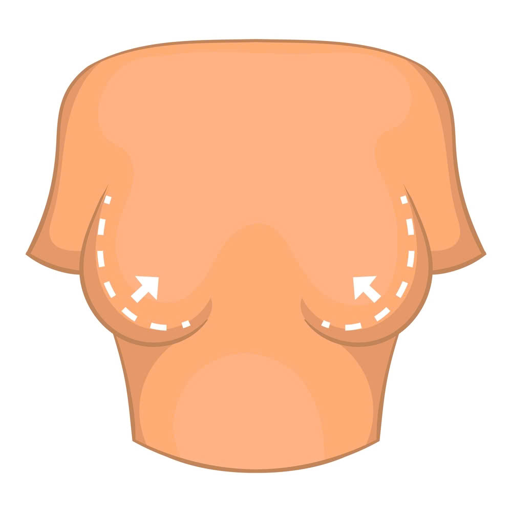 treo-sa-tre-nguc-muc-do-nang-va-nhung-dieu-quan-trong-ban-nhat-dinh-phai-biet