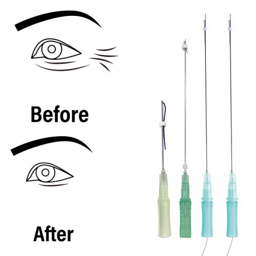 xoa-nhan-duoi-mat-bang-chi-collagen-mach-ban-bi-quyet-tre-hoa-da-vung-mat-khong-can-phau-thuat