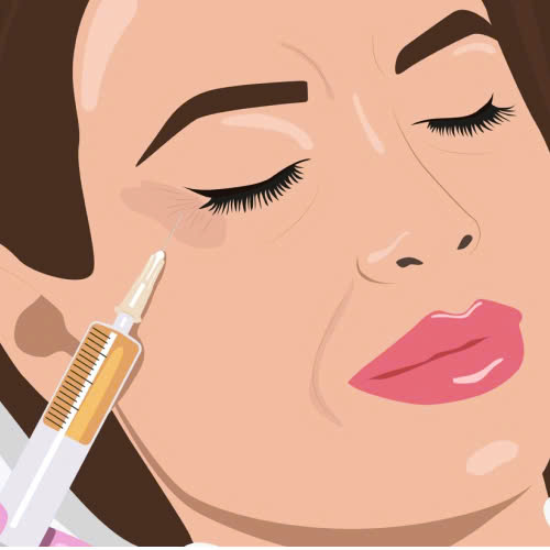 xoa-nhan-duoi-mat-bang-filler-bi-quyet-giup-doi-mat-ban-tre-hoa-an-toan-tu-nhien-ma-khong-can-phau-thuat