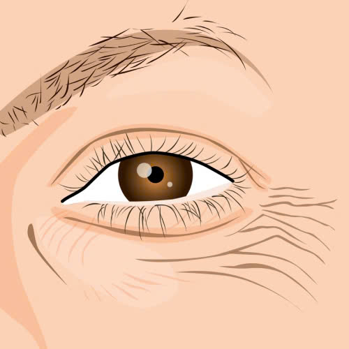 cung-tim-hieu-phuong-phap-xoa-nhan-duoi-mat-bang-laser-la-gi-uu-diem-quy-trinh-va-nhung-ai-phu-hop-voi-phuong-phap-lam-dep-nay