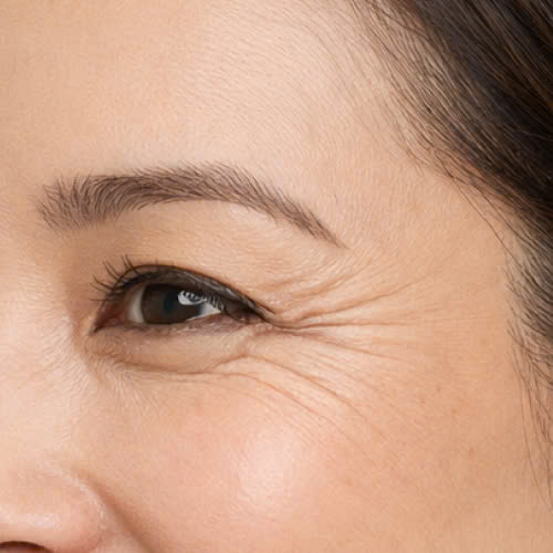 bat-mi-4-cach-xoa-nhan-duoi-mat-bang-phuong-phap-tu-nhien-an-toan-ngay-tai-nha