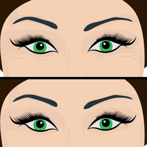 xoa-nhan-duoi-mat-cho-nguoi-lon-tuoi-bi-quyet-giu-net-thanh-xuan-khong-tuoi-tu-nhien-an-toan-khong-xam-lan