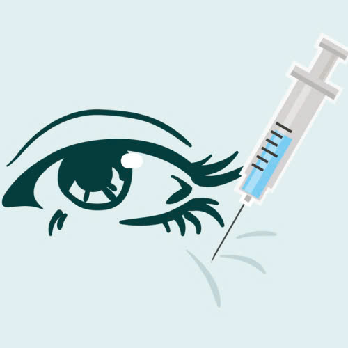 xoa-nhan-duoi-mat-co-dau-khong-tim-hieu-quy-trinh-va-meo-giam-dau-hieu-qua