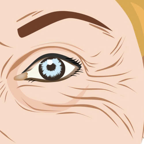 xoa-nhan-duoi-mat-gia-bao-nhieu-giai-dap-chi-tiet-nhung-phuong-phap-pho-bien-hien-nay