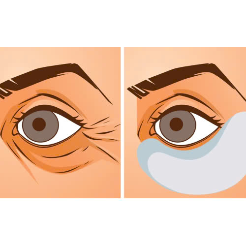 xoa-nhan-duoi-mat-giu-duoc-bao-lau-5-cach-giup-hieu-qua-keo-dai-hon-mong-doi