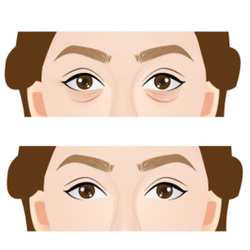 xoa-nhan-duoi-mat-giu-duoc-bao-lau-5-cach-giup-hieu-qua-keo-dai-hon-mong-doi