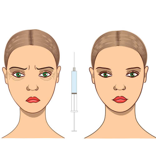 xoa-nhan-duoi-mat-khong-phau-thuat-giai-phap-tre-hoa-tu-nhien-it-xam-lan-khong-can-dao-keo