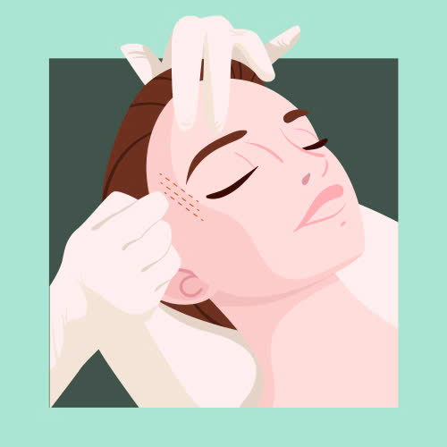 xoa-nhan-duoi-mat-o-dau-dep-mach-ban-tieu-chi-chon-noi-tham-my-an-toan-va-uy-tin