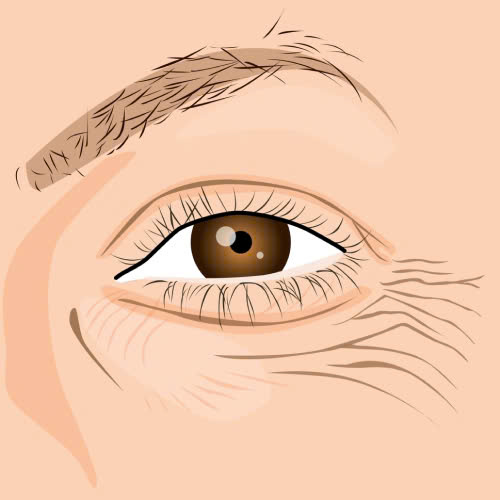 xoa-nhan-duoi-mat-o-dau-dep-mach-ban-tieu-chi-chon-noi-tham-my-an-toan-va-uy-tin