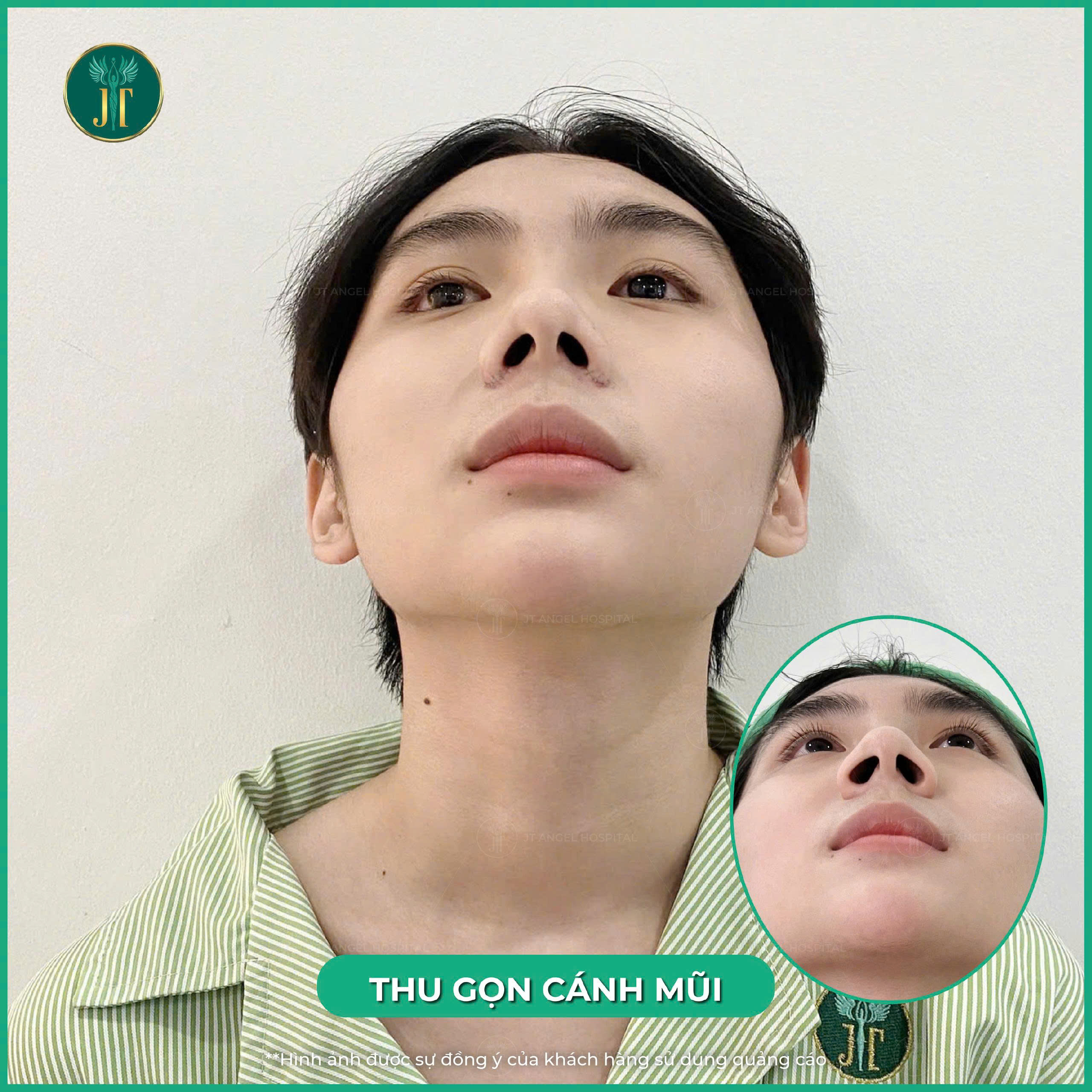 hinh-anh-truoc-va-sau-thu-gon-canh-mui-bien-hoa-ngoai-hinh-that-tuyet-voi