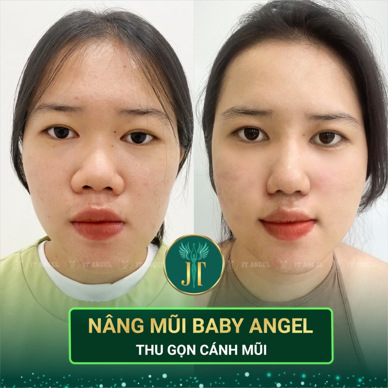 giai-dap-thac-mac-thu-gon-canh-mui-co-vinh-vien-khong-va-nhung-dieu-it-ai-noi