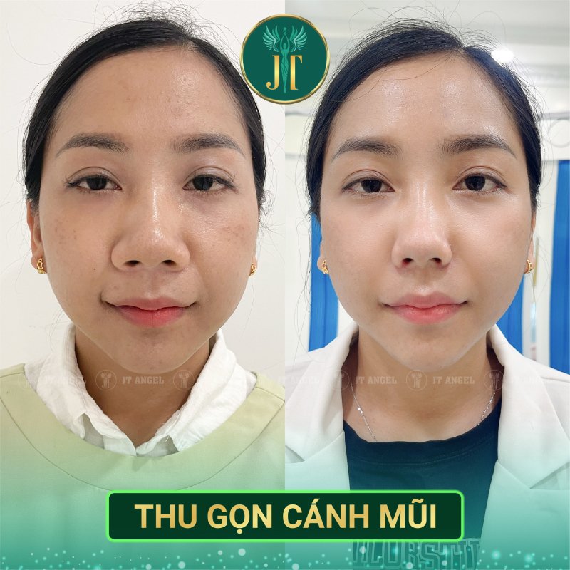 thu-gon-canh-mui-gia-bao-nhieu-doc-ngay-de-khong-bi-ho