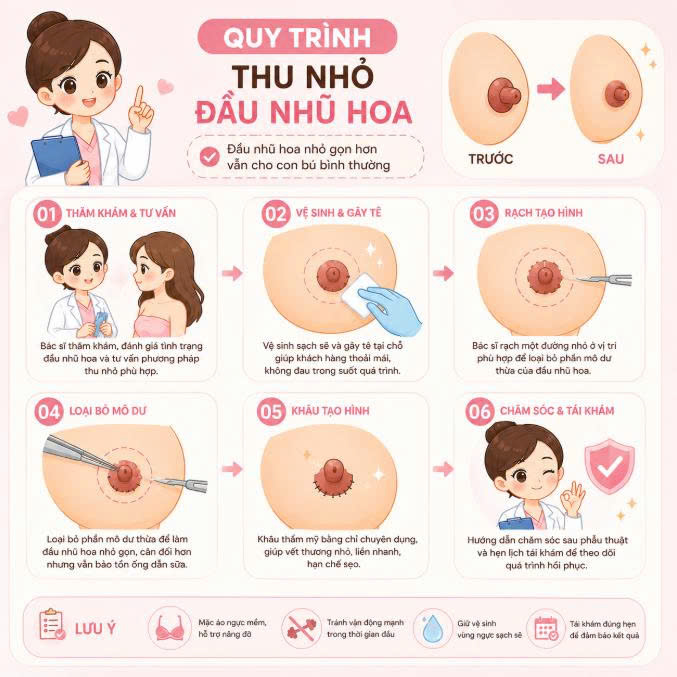 thu-nho-dau-nhu-hoa-co-cho-con-bu-duoc-khong-sau-khi-thuc-hien-co-anh-huong-tuyen-sua-khong