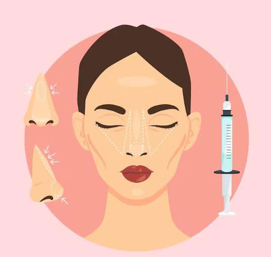tiem-filler-mui-co-sung-khong-khi-nao-la-dau-hieu-binh-thuong-khi-nao-la-nguy-hiem