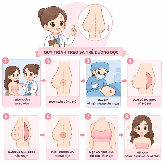 treo-sa-tre-duong-doc-co-can-dat-tui-khong-nhung-dieu-chi-em-nen-biet-truoc-khi-thuc-hien-dich-vu