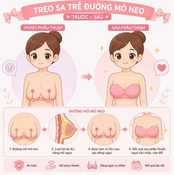 treo-sa-tre-duong-mo-neo-review-hanh-trinh-lot-xac-vong-1-chay-xe-cua-cac-chi-me-bim-sua
